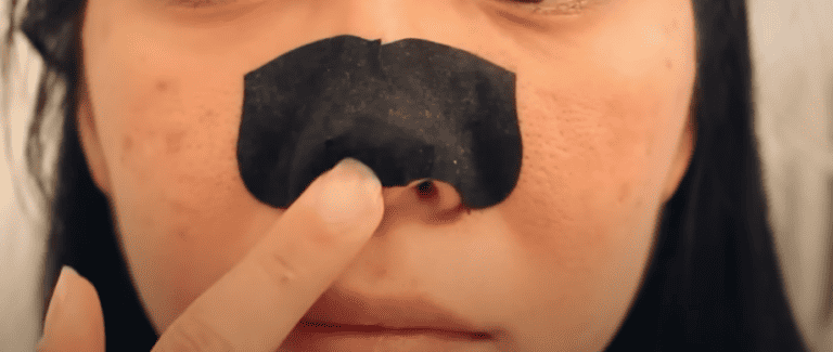 Drawbacks of Pore Strips: To Use or Not to Use?