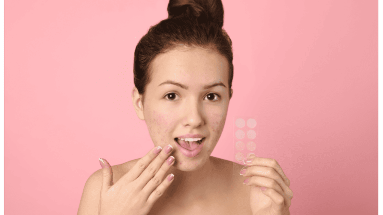 8 Best Pimple Patches in 2024