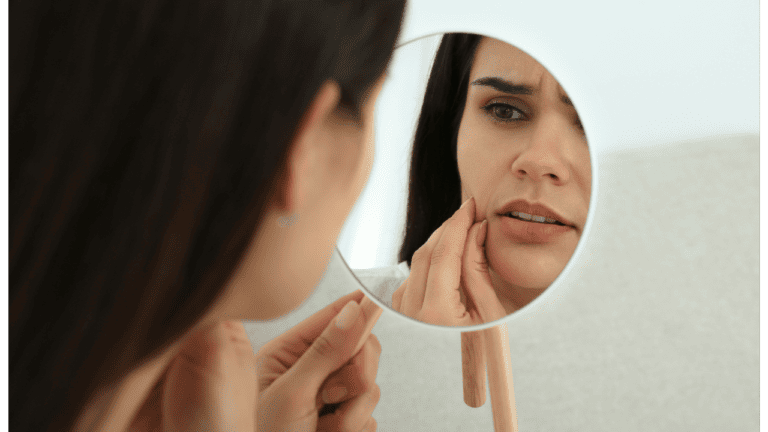 Blind Pimples: Fast and Easy Ways to Bring Them to a Head