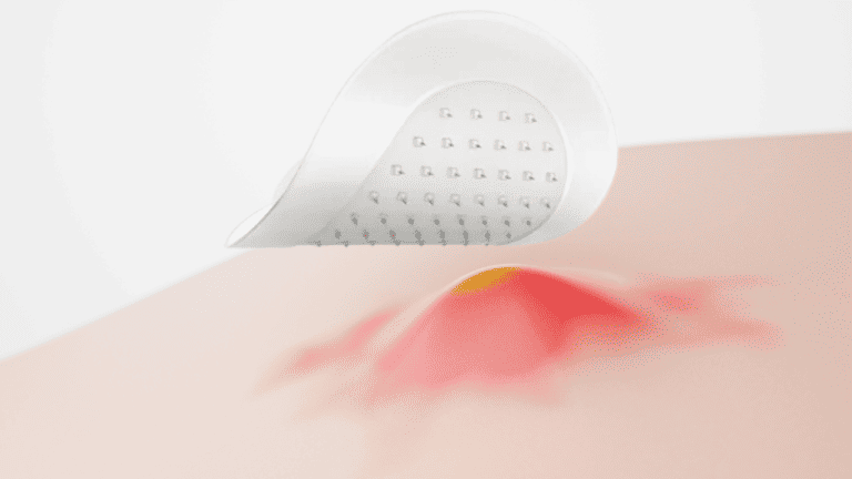 What Are Microneedle Pimple Patches? Skincare Trend