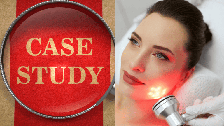 Red Light Therapy: Stunning Before and After Transformations